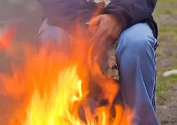 Dávky v hmotnej núdzy